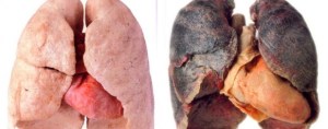 SmokersLungs-582x230